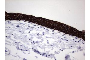 Immunohistochemistry (IHC) image for anti-Keratin Acidic (AE1) antibody (ABIN2715666) (Keratin Acidic (AE1) antibody)