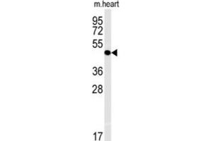 Western Blotting (WB) image for anti-Interleukin 5 Receptor, alpha (IL5RA) antibody (ABIN3002275) (IL5RA antibody)