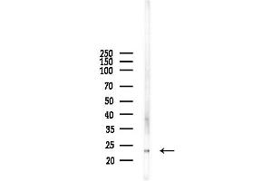 anti-Calcyon Neuron-Specific Vesicular Protein (CALY) (Internal Region) antibody