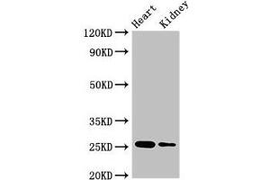 Western Blot Positive WB detected in: Mouse heart tissue, Mouse kidney tissue All lanes: CSH2 antibody at 4 μg/mL Secondary Goat polyclonal to rabbit IgG at 1/50000 dilution Predicted band size: 25, 19, 14 kDa Observed band size: 25 kDa (CSH1 antibody  (AA 27-217))