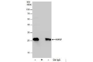 IP Image Immunoprecipitation of HSP27 protein from HeLa whole cell extracts using 5 μg of HSP27 antibody, Western blot analysis was performed using HSP27 antibody, EasyBlot anti-Rabbit IgG  was used as a secondary reagent. (HSP27 antibody  (Center))
