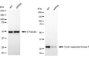 Western blotting analysis using cyclin dependent kinase 5 antibody (ABIN7798217). (Recombinant CDK5 antibody)