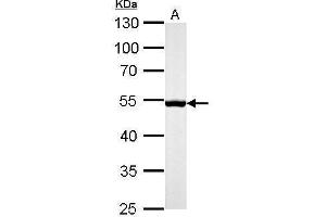Western Blotting (WB) image for anti-Desmin (DES) antibody (ABIN2855655)