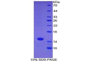 SDS-PAGE analysis of Mouse S100A7 Protein.