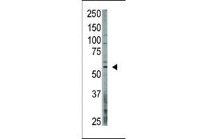 Antibody is used in Western blot to detect OASIS in A375 lysate. (CREB3L1 antibody  (C-Term))