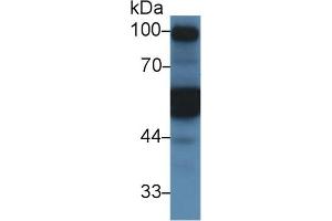 Detection of a1AT in Mouse Kidney lysate using Polyclonal Antibody to Alpha-1-Antitrypsin (a1AT) (SERPINA1 antibody  (AA 25-413))