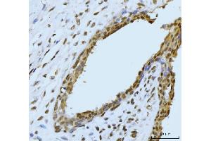 IHC analysis of SBNO1 using anti-SBNO1 antibody (ABIN7601710).