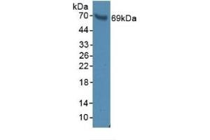 Detection of BFP in Rat Serum using Polyclonal Antibody to Brain Finger Protein (BFP) (RNF112 antibody  (AA 256-504))