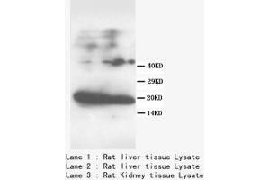 Image no. 2 for anti-Fatty Acid Binding Protein 1, Liver (FABP1) (N-Term) antibody (ABIN1495134) (FABP1 antibody  (N-Term))
