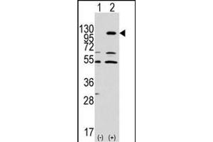 Western blot analysis of EphA7 (arrow) using rabbit polyclonal EphA7 Antibody (ABIN391900 and ABIN2841718). (EPH Receptor A7 antibody)