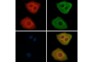ABIN6264912 and ABIN6269293 staining Hela cells by IF/ICC. (RPS6 antibody  (C-Term))