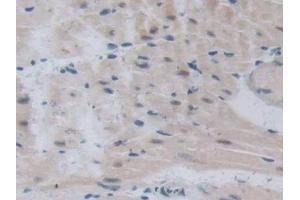 Immunohistochemistry (IHC) image for anti-Transcription Factor 20 (TCF20) (AA 1871-1965) antibody (ABIN7438469)
