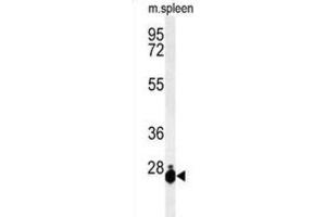 Western Blotting (WB) image for anti-THO Complex 7 (THOC7) antibody (ABIN3004372) (THOC7 antibody)