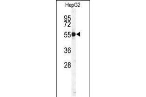 Western blot analysis of CTSH Antibody in HepG2 cell line lysates (35ug/lane) (Cathepsin H antibody  (N-Term))