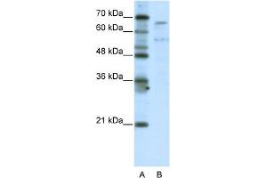 WB Suggested Anti-TAF6L Antibody Titration:  5.