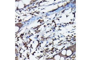 Immunohistochemistry of paraffin-embedded human colon using G Rabbit pAb (ABIN6129931, ABIN6137010, ABIN6137011 and ABIN6217659) at dilution of 1:100 (40x lens). (APOBEC3G antibody  (AA 60-330))