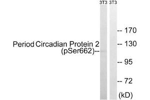 Western blot analysis of extracts from 3T3 cells, treated with PMA (125 ng/mL, 30 mins), using Period Circadian Protein 2 (Phospho-Ser662) antibody. (PER2 antibody  (pSer662))