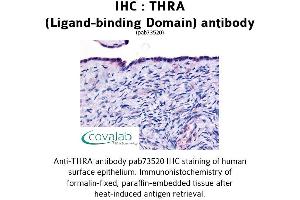 Image no. 1 for anti-Thyroid Hormone Receptor, alpha (THRA) antibody (ABIN1740044) (THRA antibody)