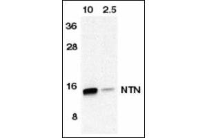 Western blot analysis of NTN in HeLa cell lyaste containing 10 or 2. (Neurturin antibody  (AA 178-193))