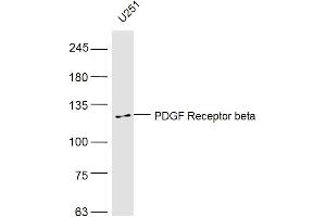 U251 lysates probed with PDGF Receptor beta Polyclonal Antibody, Unconjugated  at 1:500 dilution and 4˚C overnight incubation. (PDGFRB antibody  (AA 981-1066))