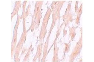 Immunohistochemistry of ATG9A in human heart tissue with ATG9A antibody at 5 μg/mL. (ATG9A antibody  (C-Term))