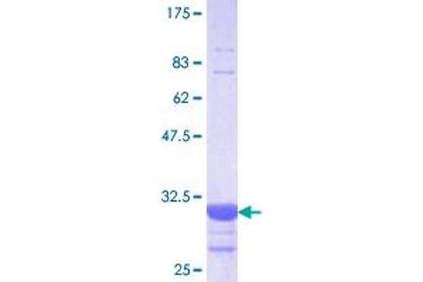 SLC5A2 Protein (AA 228-277) (GST tag)