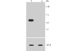 Lane 1: NIH/3T3 treated with PDGF, Lane 2: NIH/3T3 untreatedlysates probed with Akt1(Ser473) (12A1) Monoclonal Antibody  at 1:1000 overnight at 4˚C. (AKT1 antibody  (pSer473))