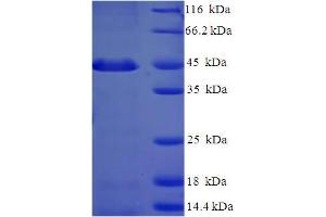 PSMF1 Protein (AA 1-271, full length) (His-SUMO Tag)