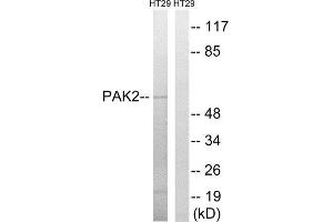 Western Blotting (WB) image for anti-P21-Activated Kinase 2 (PAK2) (Ser62) antibody (ABIN1848252) (PAK2 antibody  (Ser62))