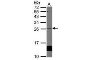 Image no. 1 for anti-Cytoglobin (CYGB) (AA 1-190) antibody (ABIN1501883) (CYGB antibody  (AA 1-190))