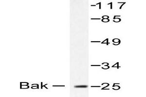 Image no. 1 for anti-BCL2-Antagonist/killer 1 (BAK1) antibody (ABIN265324) (BAK1 antibody)
