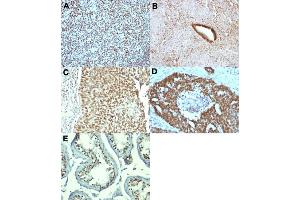 Immunohistochemical staining (Formalin-fixed paraffin-embedded sections) of human tonsil (A), human skin (B), human uterus (C), human bladder carcinoma (D) and human ovarian carcinoma (E) with NCL monoclonal antibody, clone NCL/902 .