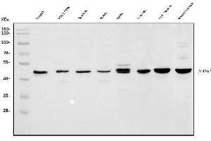Western blot analysis of HOMER1 using anti-HOMER1 antibody (ABIN7599982).