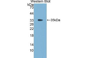 Detection of Recombinant FGg, Cattle using Polyclonal Antibody to Fibrinogen Gamma (FGg) (FGG antibody  (AA 168-444))