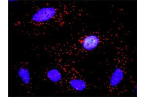 Proximity Ligation Analysis of protein-protein interactions between CCNE1 and CDKN1A. (Cyclin E1 antibody  (AA 1-410))