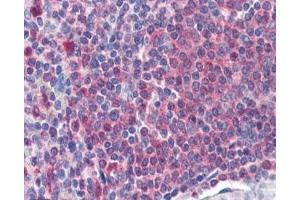 IHC staining of FFPE human spleen with Catalase antibody at 2ug/ml. (Catalase antibody)