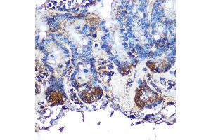 Immunohistochemistry of paraffin-embedded mouse intestin using ITLN1 Rabbit pAb (ABIN6132446, ABIN6142601, ABIN6142602 and ABIN6223070) at dilution of 1:100 (40x lens). (ITLN1/Omentin antibody  (AA 19-313))