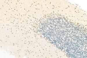 Immunohistochemistry (Paraffin-embedded Sections) (IHC (p)) image for anti-RNA Polymerase II Associated Protein 2 (RPAP2) antibody (ABIN7075481)