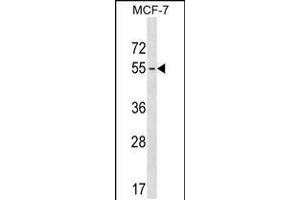 Western blot analysis in MCF-7 cell line lysates (35ug/lane). (MAGEB18 antibody  (AA 214-242))