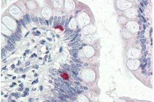 Human Small Intestine (formalin-fixed, paraffin-embedded) stained with COPA antibody ABIN337288 at 5 ug/ml followed by biotinylated goat anti-rabbit IgG secondary antibody ABIN481713, alkaline phosphatase-streptavidin and chromogen. (COPA antibody  (AA 1-19))