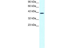 WB Suggested Anti-CCRN4L Antibody Titration:  1. (CCRN4L antibody  (N-Term))