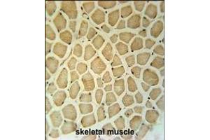 RPS3A Antibody (C-term) (ABIN651720 and ABIN2840374) immunohistochemistry analysis in formalin fixed and paraffin embedded human skeletal muscle followed by peroxidase conjugation of the secondary antibody and DAB staining. (RPS3A antibody  (C-Term))