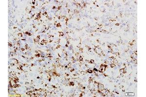 Immunohistochemistry (Paraffin-embedded Sections) (IHC (p)) image for anti-Preferentially Expressed Antigen in Melanoma (PRAME) (AA 151-250) antibody (ABIN721555)