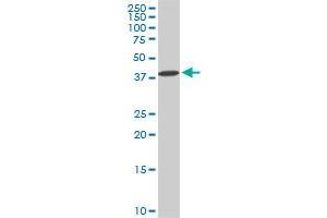 DCPS monoclonal antibody (M02), clone 1G4. (DCPS antibody  (AA 1-337))