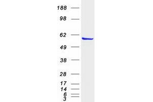 Western Blotting (WB) image for Inosine 5'-Phosphate Dehydrogenase 1 (IMPDH1) (Transcript Variant 1) protein (Myc-DYKDDDDK Tag) (ABIN2723435)