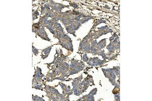 IHC analysis of BubR1/BUB1B using anti-BubR1/BUB1B antibody (ABIN7600960).