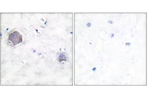 Immunohistochemical analysis of paraffin-embedded human brain tissue, using Notch 1 (cleaved-Val1744) antibody. (Notch1 antibody  (Cleaved-Val1754, Internal Region))