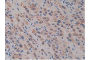 IHC-P analysis of Mouse Liver Tissue, with DAB staining. (SLIT1 antibody  (AA 603-773))