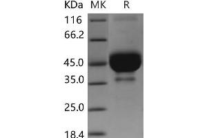 Bone Marrow Stromal Cell Antigen 2 (BST2) protein (Fc Tag)