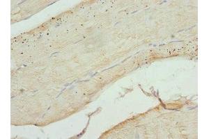 Immunohistochemistry of paraffin-embedded human skeletal muscle tissue using ABIN7148048 at dilution of 1:100 (Cofilin 2 antibody  (AA 1-166))